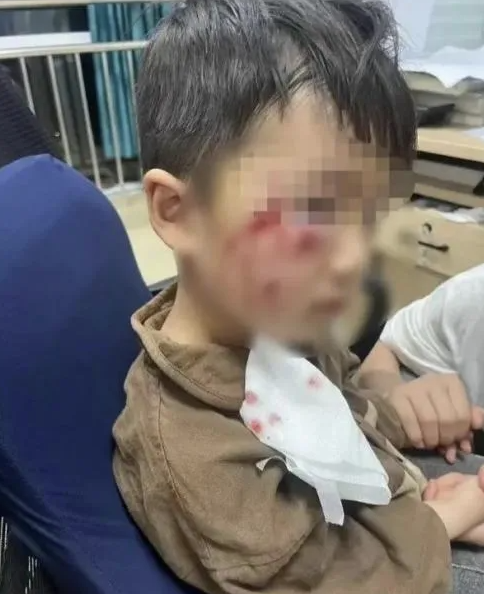 被瘋?cè)麤](méi)有“救命藥”，怎么辦？